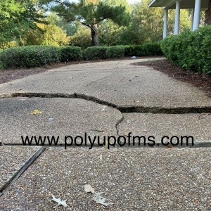 Photo of PolyUp of MS