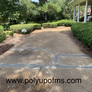 Photo of PolyUp of MS